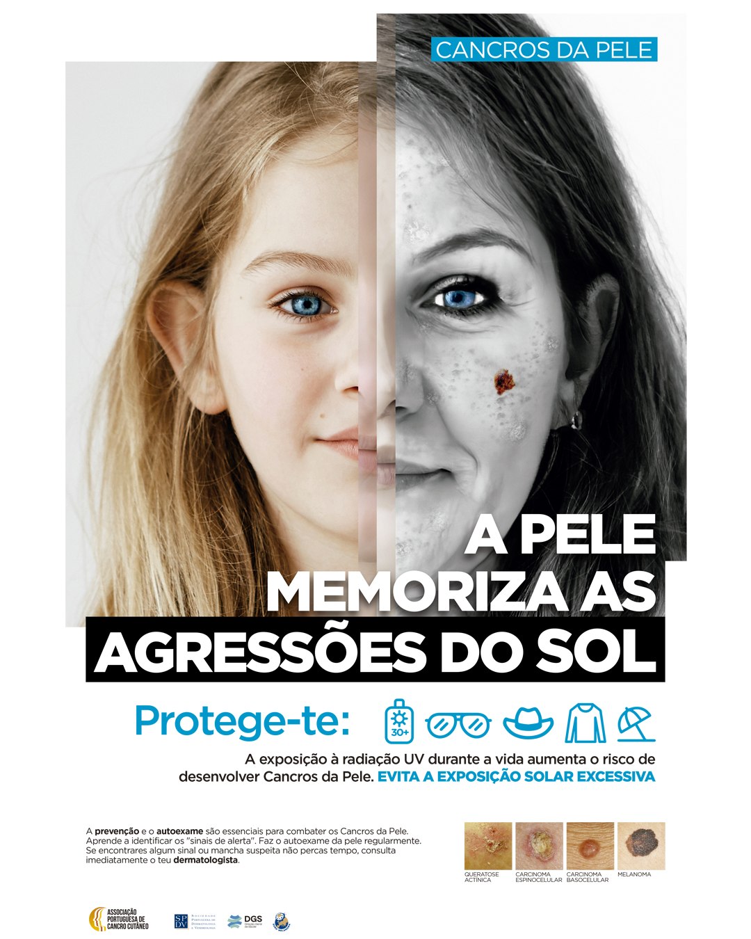 Município associa-se a Campanha de Prevenção do Cancro da Pele